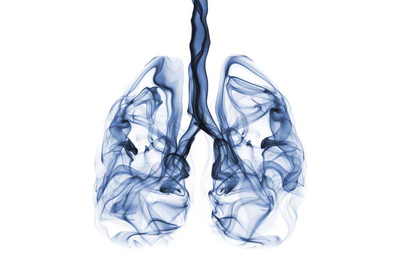 驚爆！“電子煙肺炎肺損傷”原來早在一年前在台灣已經出現了_圖取自UPMC